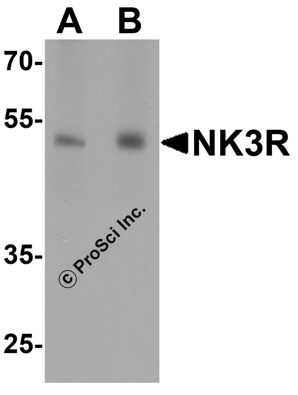 Western blot analysis of NK3R in RAW264.7 cell lysate with NK3R antibody at (A) 0.5 and (B) 1 &#956;g/mL.