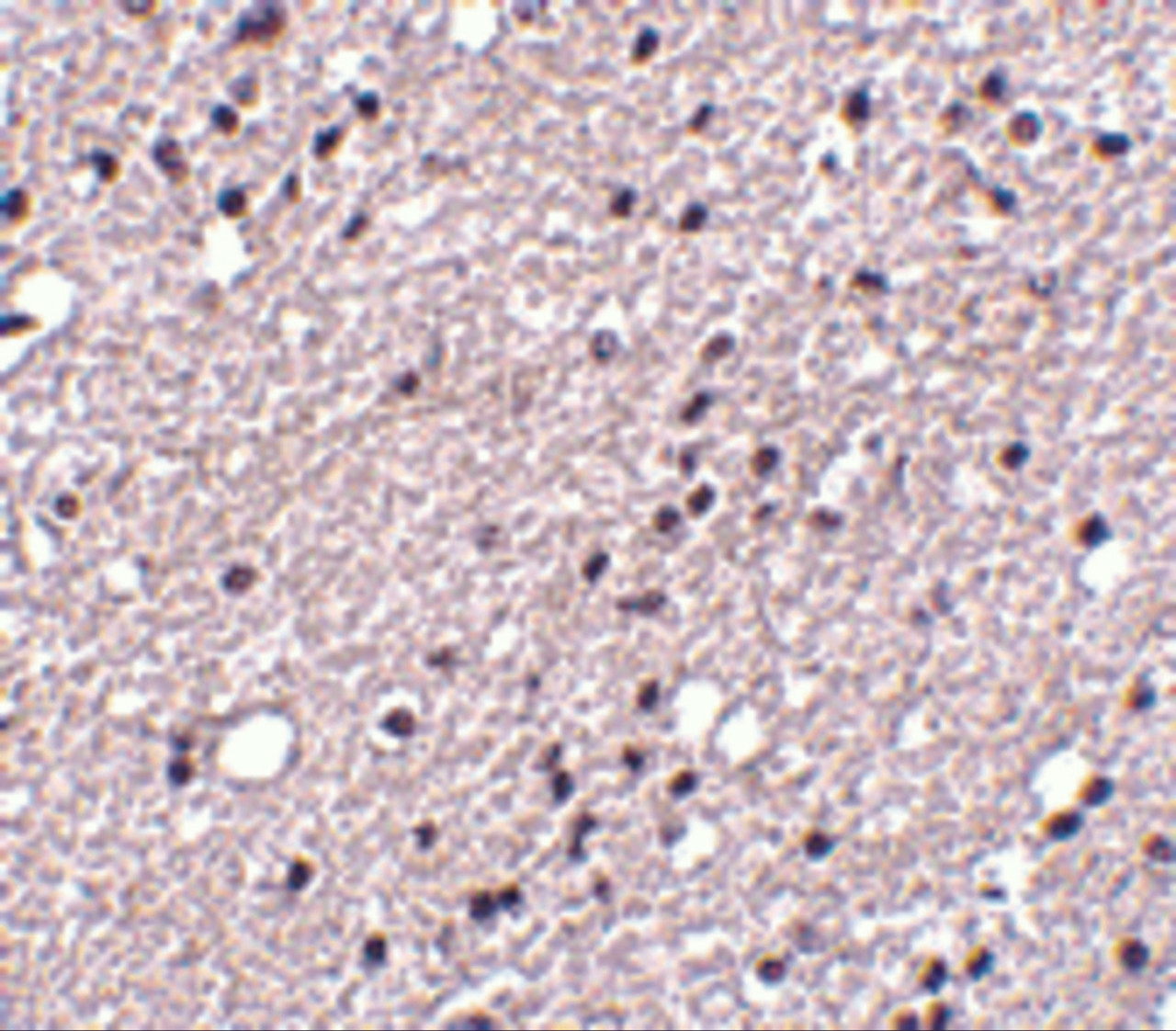 Immunohistochemistry of NK3R in human brain tissue with NK3R antibody at 5 ug/mL.