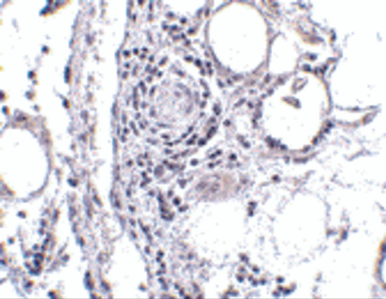 Immunohistochemistry of FABP7 in human breast tissue with FABP7 antibody at 5 ug/mL.