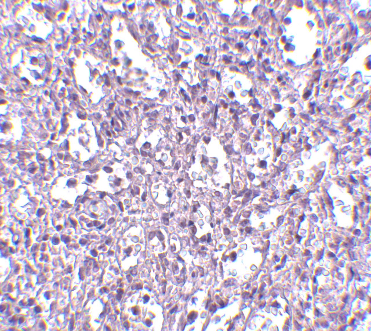 Immunohistochemistry of Carabin in human spleen tissue with Carabin antibody at 2.5 ug/mL.