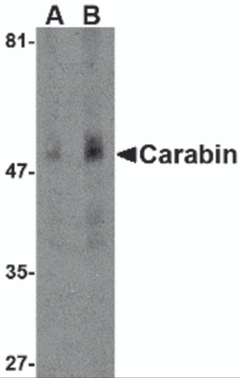 Western blot analysis of Carabin in human spleen tissue lysate with Carabin antibody at (A) 1 and (B) 2 &#956;g/mL.