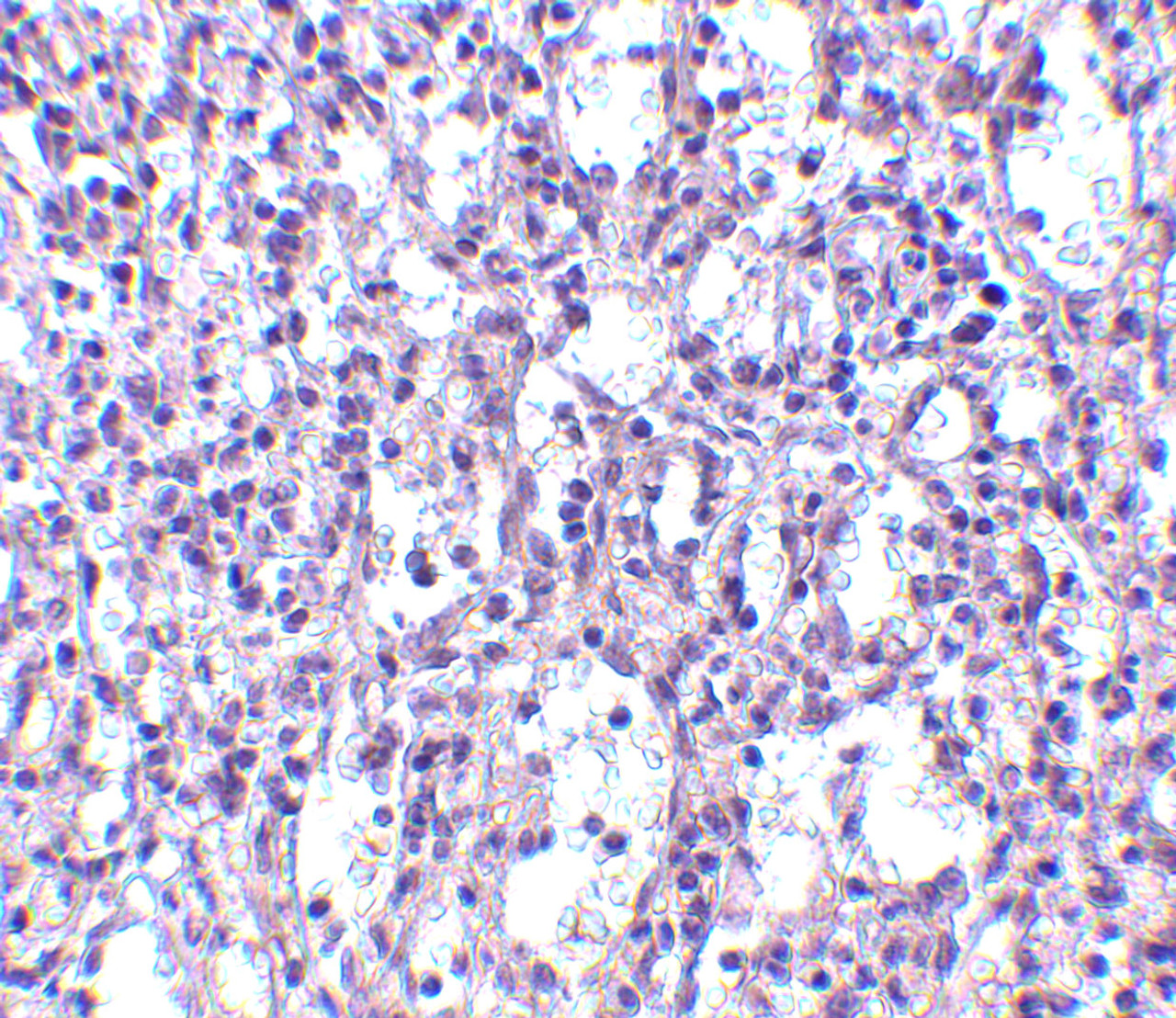 Immunohistochemistry of Carabin in human spleen tissue with Carabin antibody at 2.5 ug/mL.