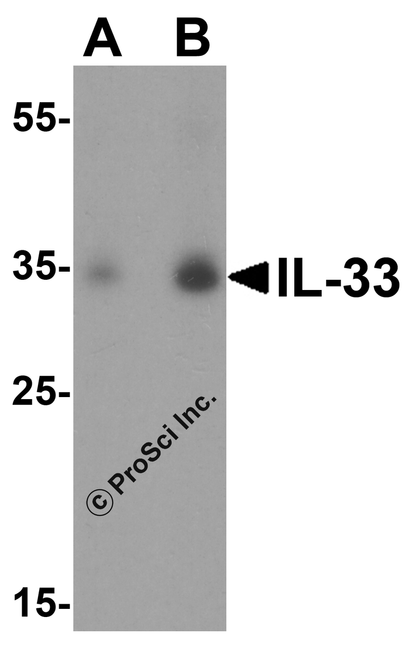 Figure 1 Western Blot Validation of IL-33 in A20 Cells 
Loading: 15 &#956;g of lysates per lane.
Antibodies: IL-33, 4273, 1h incubation at RT in 5% NFDM/TBST.
Secondary: Goat anti-rabbit IgG HRP conjugate at 1:10000 dilution.
Lane A: 1 &#956;g/mL
Lane B: 2 &#956;g/mL