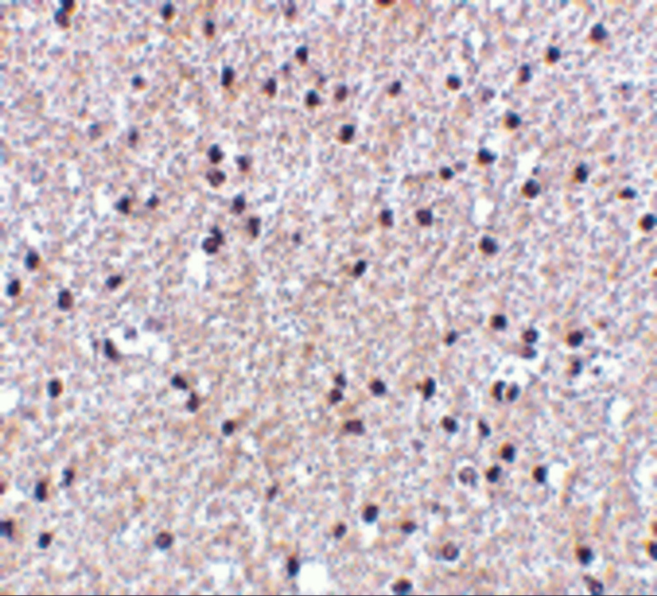 Immunohistochemistry of MORF4 in human brain tissue with MORF4 antibody at 5 ug/mL.