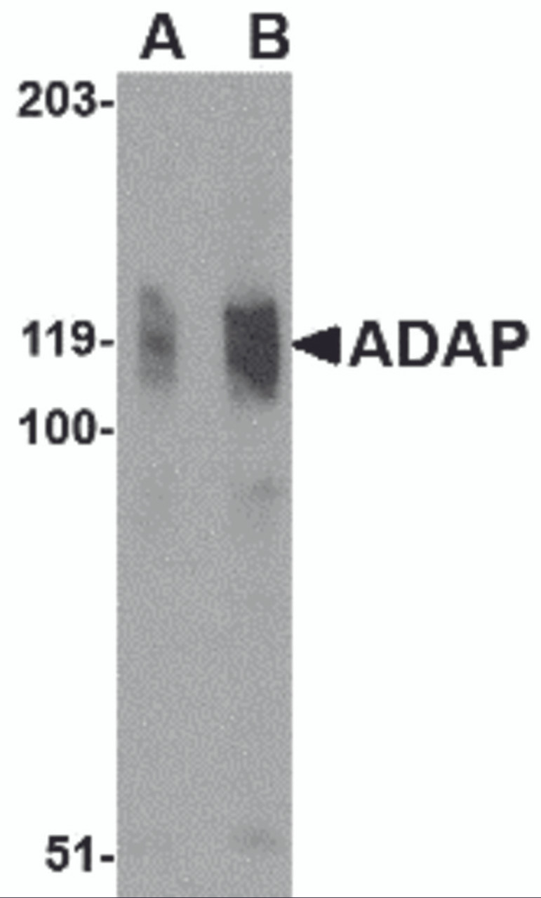 Western blot analysis of ADAP in K562 cell lysate with ADAP antibody at (A) 0.5 and (B) 1 &#956;g/mL.