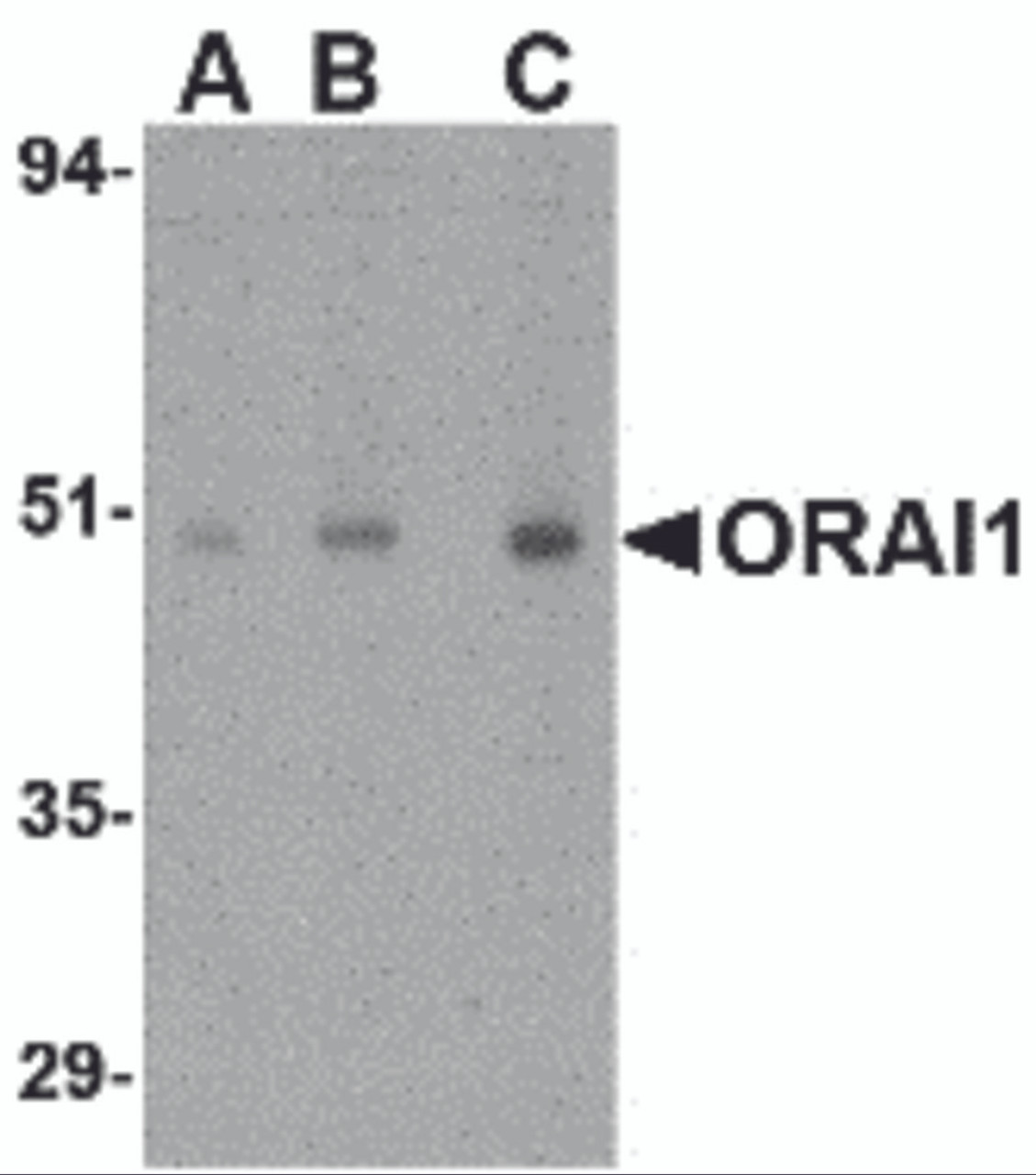 Western blot analysis of ORAI1 in human ovary tissue lysate with ORAI1 antibody at (A) 0.5, (B) 1 and (C) 2 &#956;g/mL.