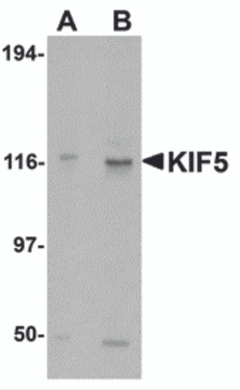 Western blot analysis of KIF5 in K562 cell lysate with KIF5 antibody at (A) 0.5 and (B) 1 &#956;g/mL.