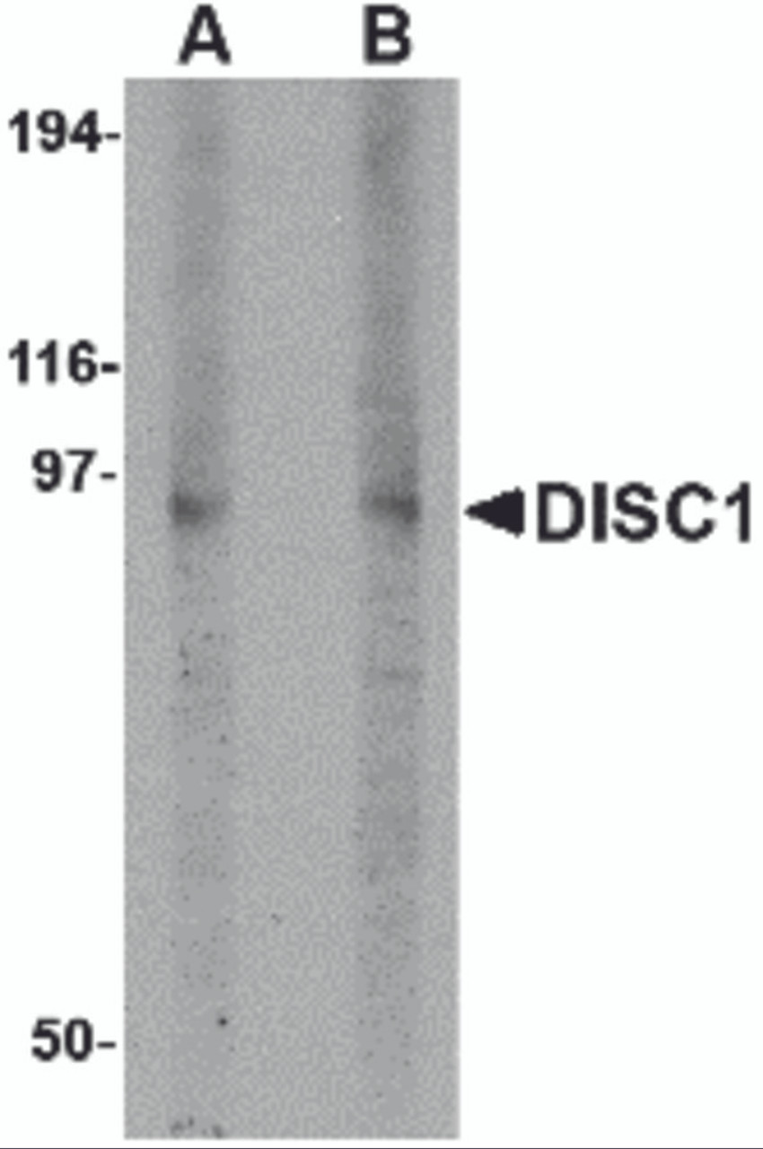 Western blot analysis of DISC1 in 3T3 cell lysate with DISC1 antibody at (A) 1 and (B) 2 &#956;g/mL.