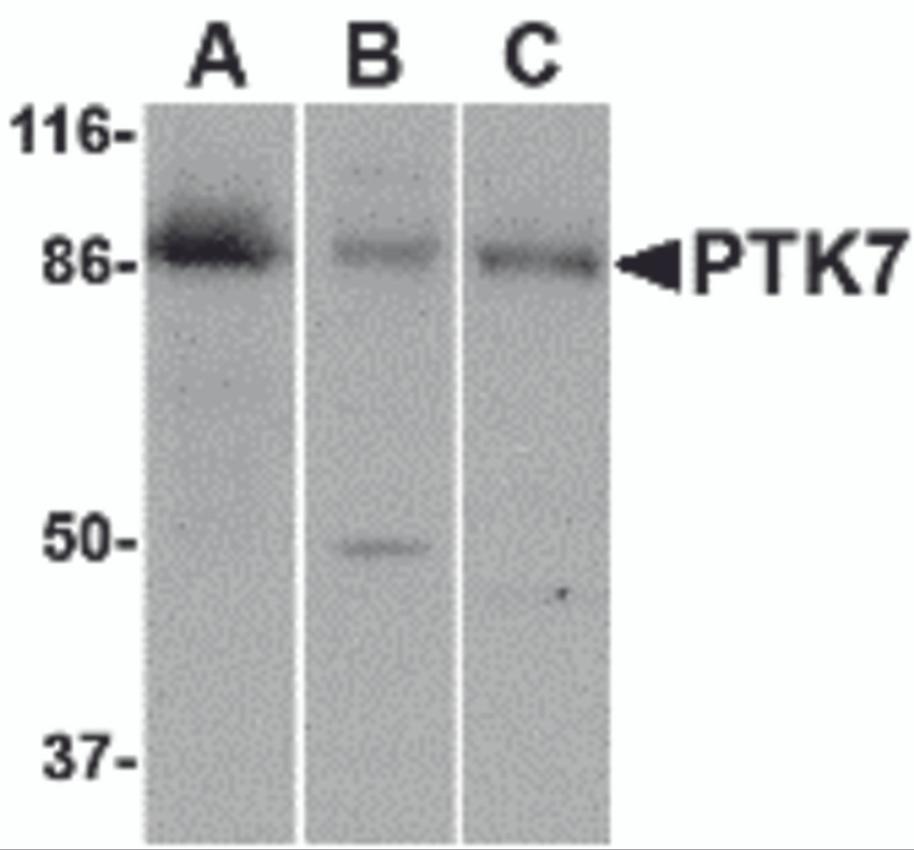 Western blot analysis of PTK7 in (A) human colon, (B) mouse kidney and (C) rat liver tissue lysate with PTK7 antibody at 1 &#956;g/mL.