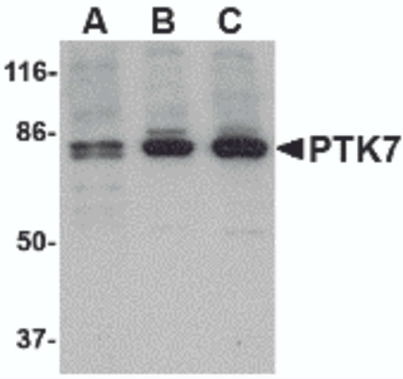 Western blot analysis of PTK7 in (A) human, (B) mouse and (C) rat colon tissue lysate with PTK7 antibody at 1 &#956;g/mL.