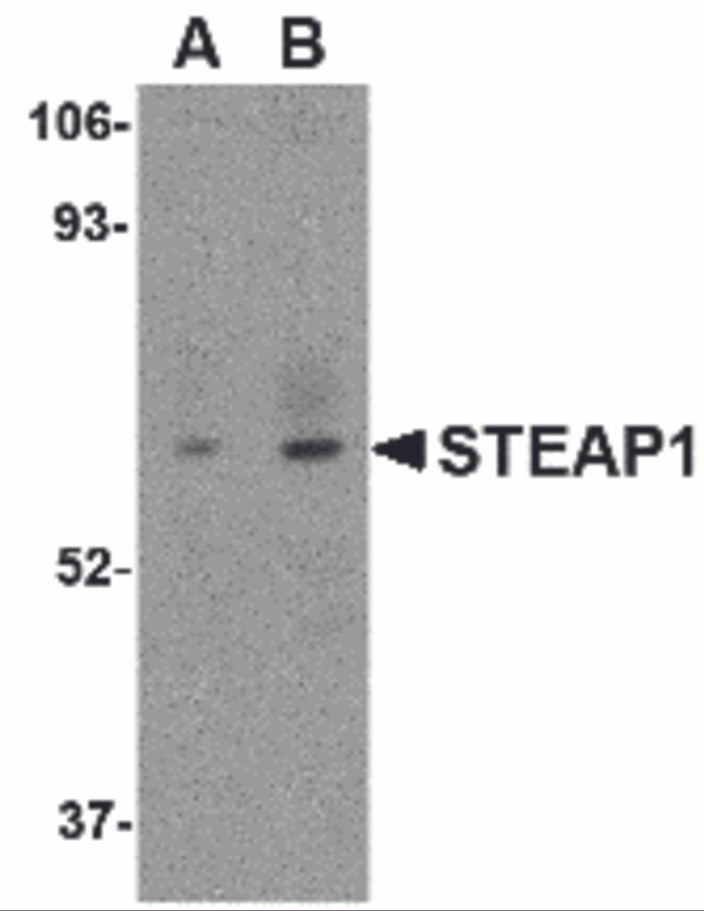 Western blot analysis of STEAP1 in human spleen tissue lysate with STEAP1 antibody at (A) 1 and (B) 2 &#956;g/mL.