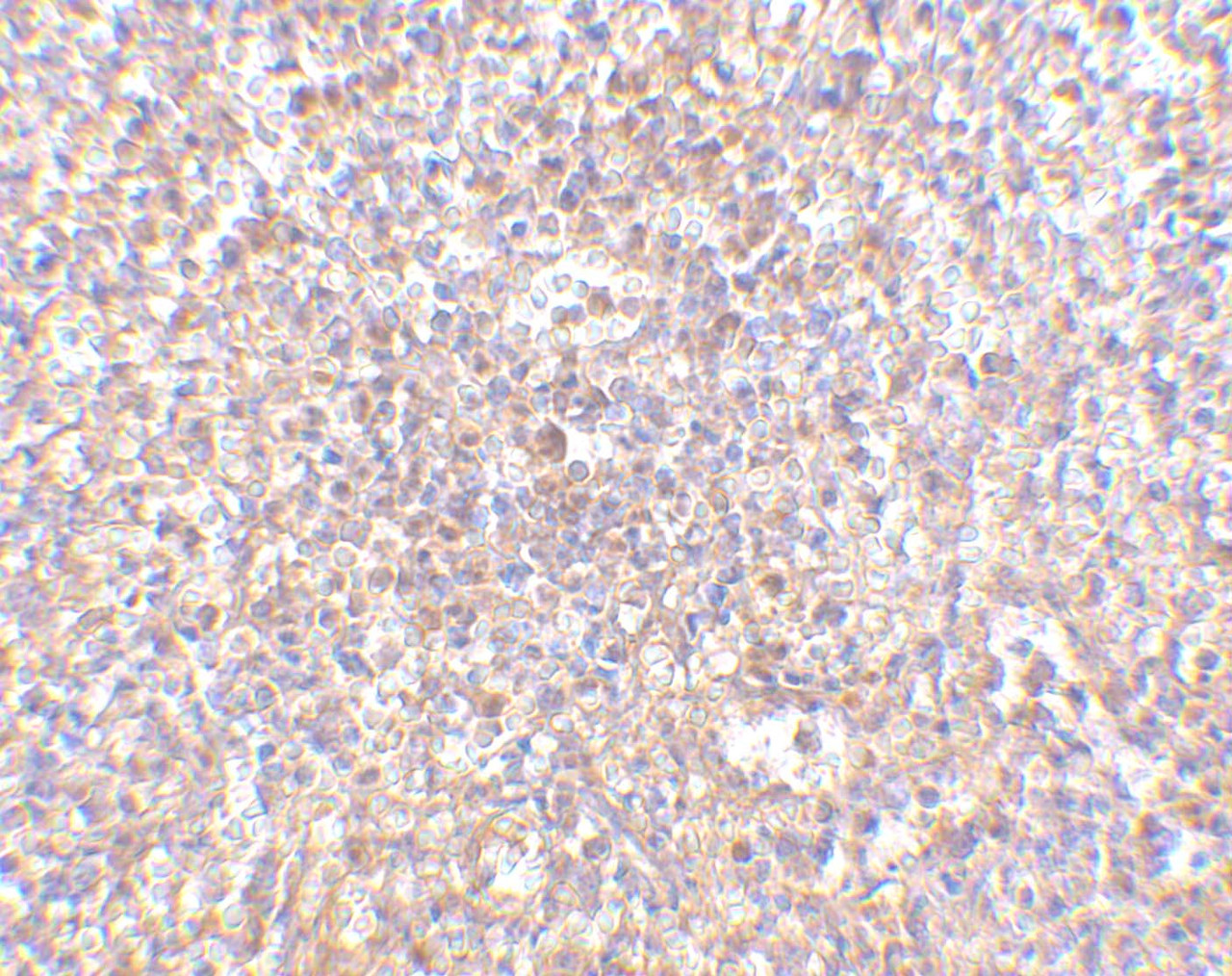 Immunohistochemistry of STEAP1 in human spleen tissue with STEAP1 antibody at 2.5 ug/mL.