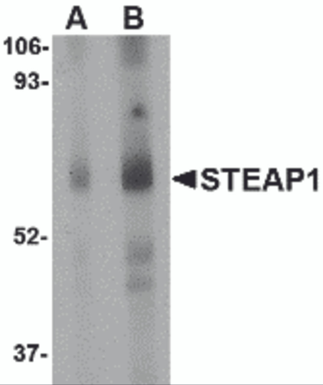 Western blot analysis of STEAP1 in human spleen tissue lysate with STEAP1 antibody at (A) 1 and (B) 2 &#956;g/mL.