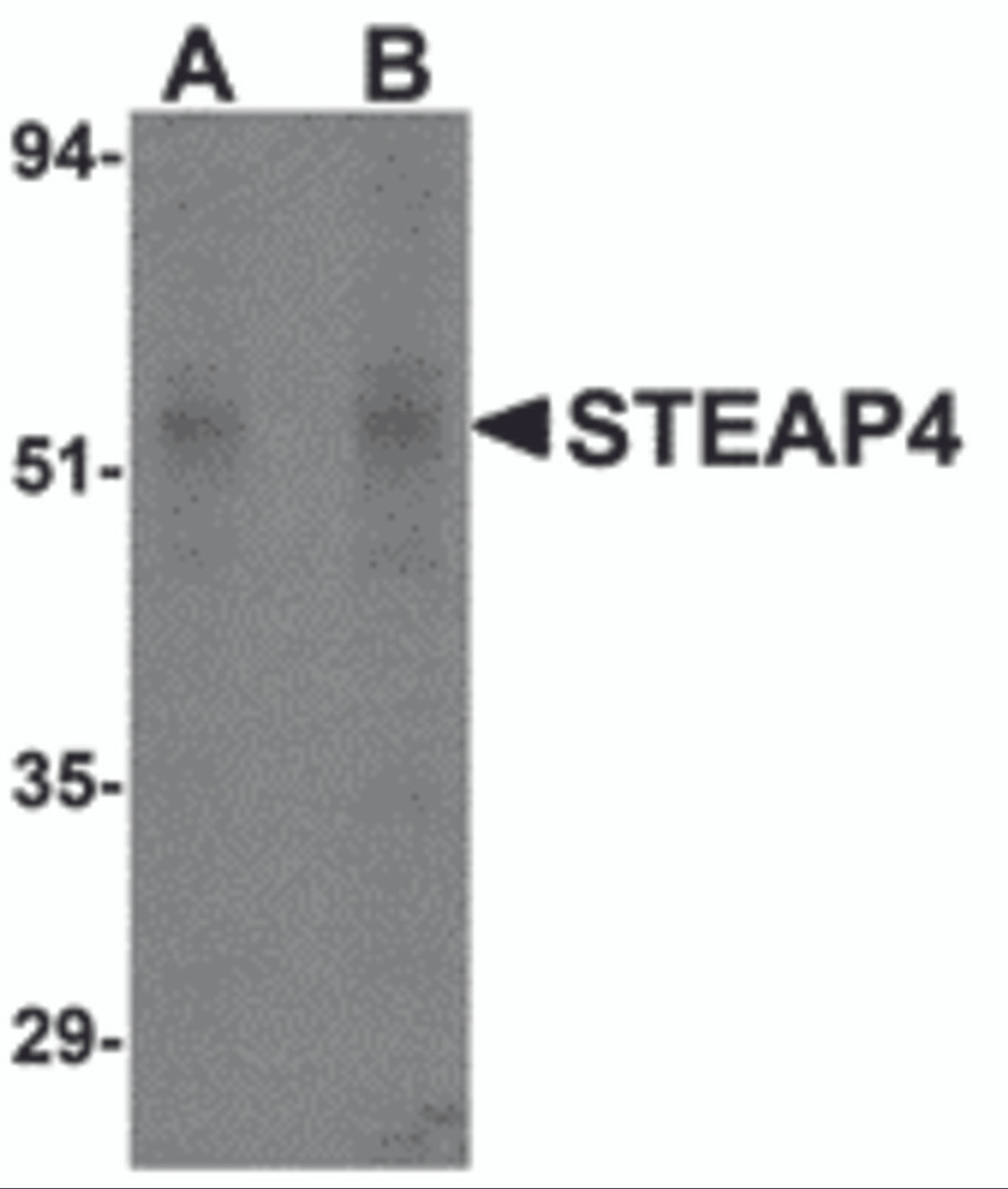 Western blot analysis of STEAP4 in rat liver tissue lysate with STEAP4 antibody at (A) 0.5 and (B) 1 &#956;g/mL.