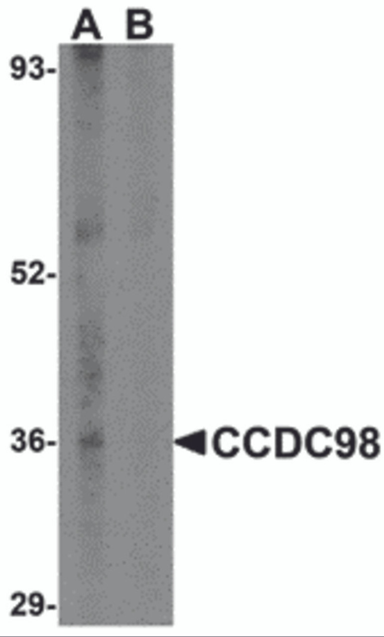 Western blot analysis of CCDC98 in human breast tissue lysate in (A) the absence and (B) presence of blocking peptide with CCDC98 antibody at 1 &#956;g/mL.