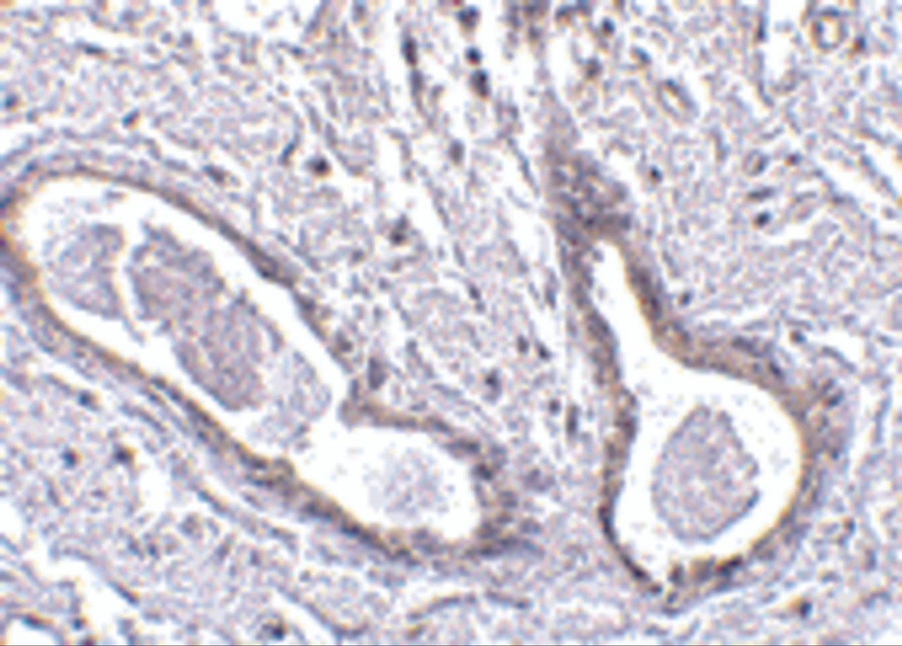 Immunohistochemistry of CCDC98 in human breast tissue with CCDC98 antibody at 5 ug/mL.