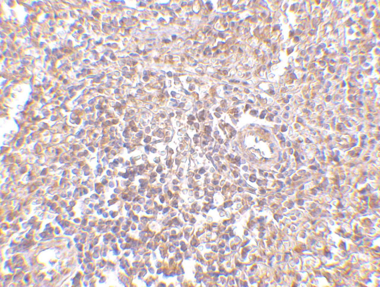 Immunohistochemistry of RAP80 in human spleen tissue with RAP80 antibody at 2.5 ug/mL.