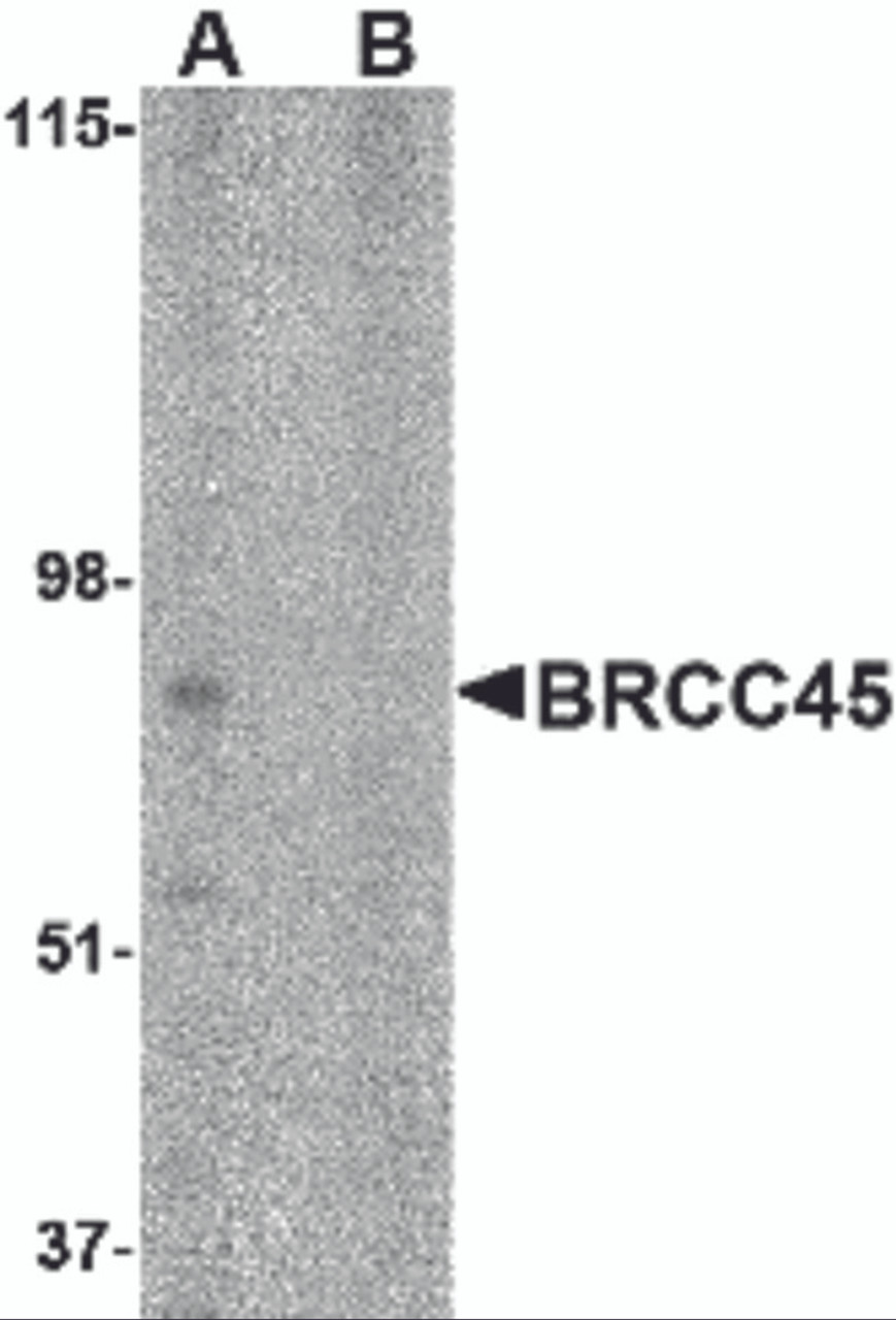 Western blot analysis of BRCC45 in HeLa cell lysate in (A) the absence and (B) presence of blocking peptide with BRCC45 antibody at 1 &#956;g/mL.