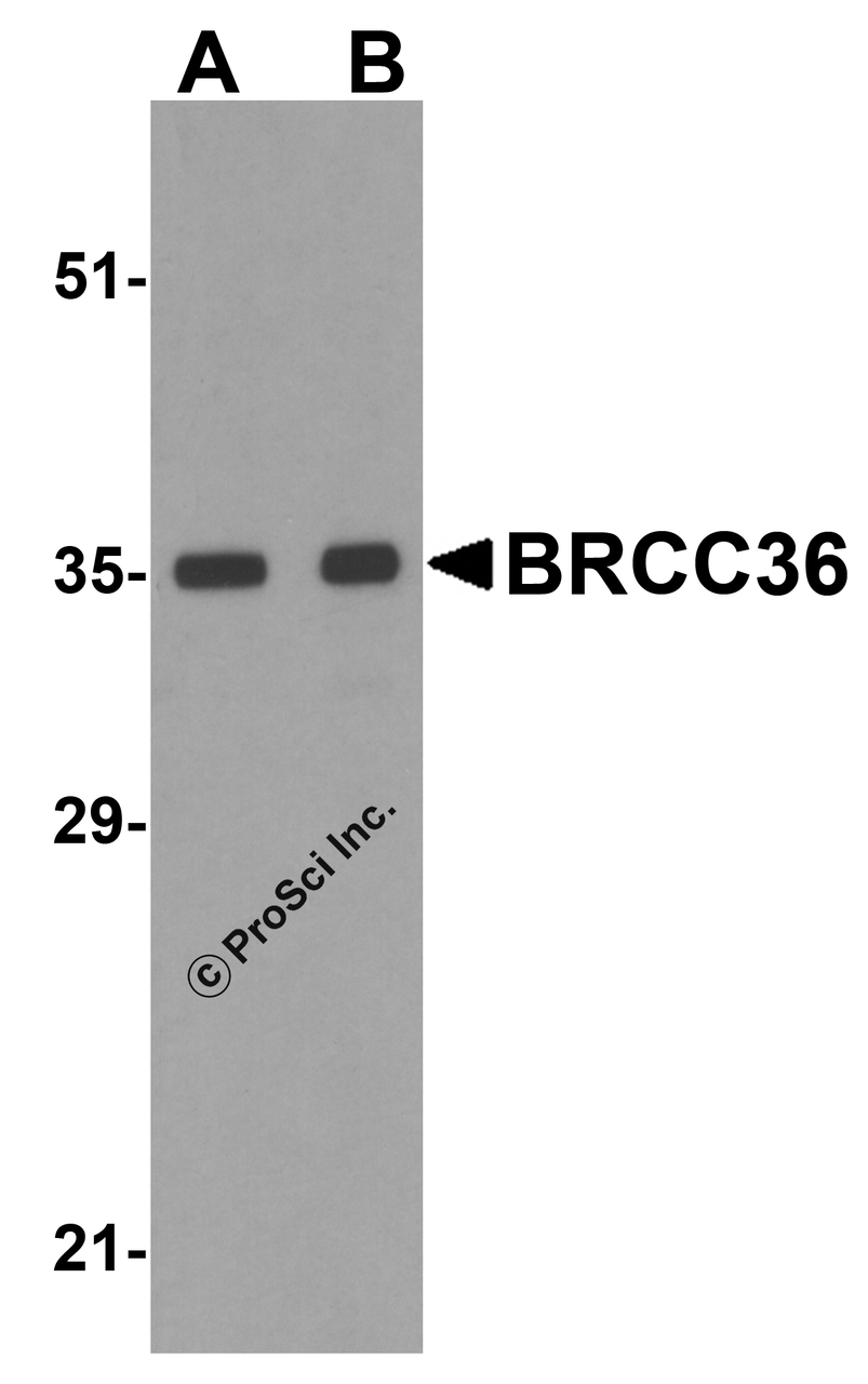 Western blot analysis of BRCC36 in MCF7 cell lysate with BRCC36 antibody at (A) 0.5 and (B) 1 &#956;g/mL.