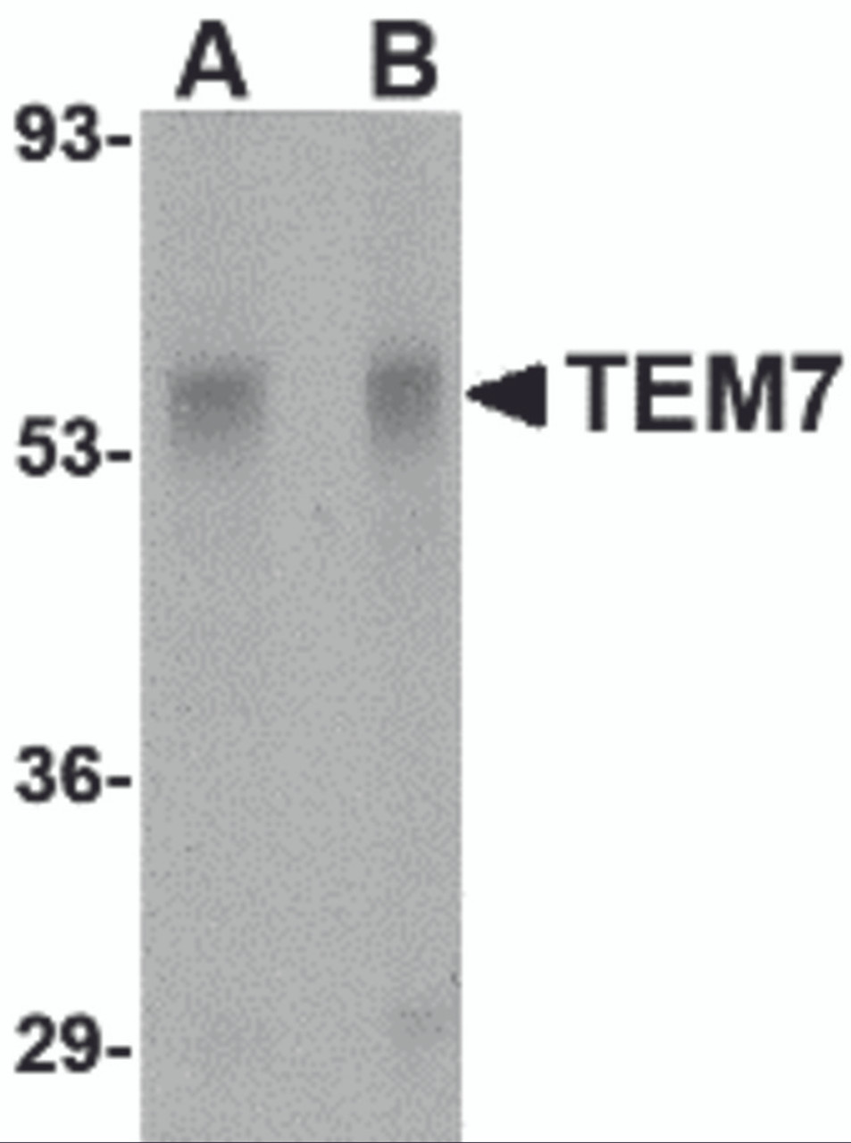Western blot analysis of TEM7 in rat liver tissue lysate with TEM7 antibody at (A) 0.5 and (B) 1 &#956;g/mL.