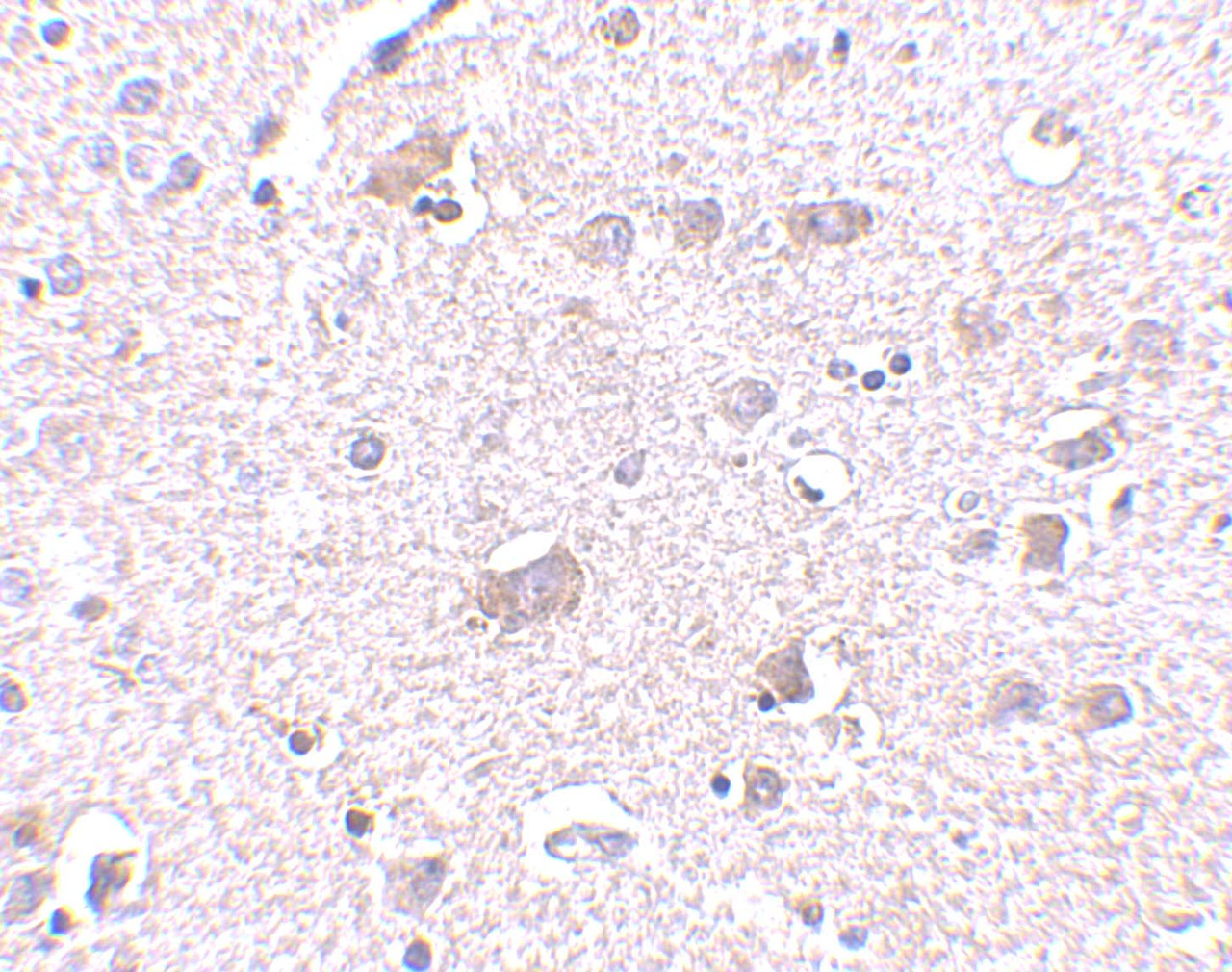 Immunohistochemistry of CDNF in human brain tissue with CDNF antibody at 2.5 ug/mL.