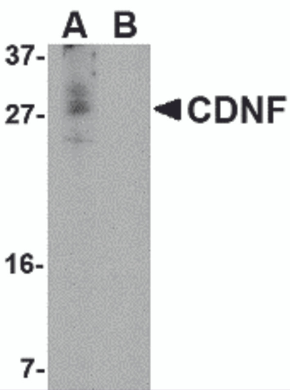Western blot analysis of CDNF in A-20 cell lysate in (A) the absence and (B) the presence of blocking peptide with CDNF antibody at 1 &#956;g/mL.