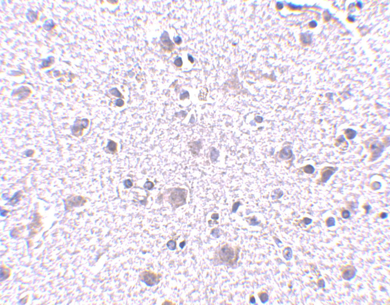 Immunohistochemistry of CDNF in human brain tissue with CDNF antibody at 5 ug/mL.