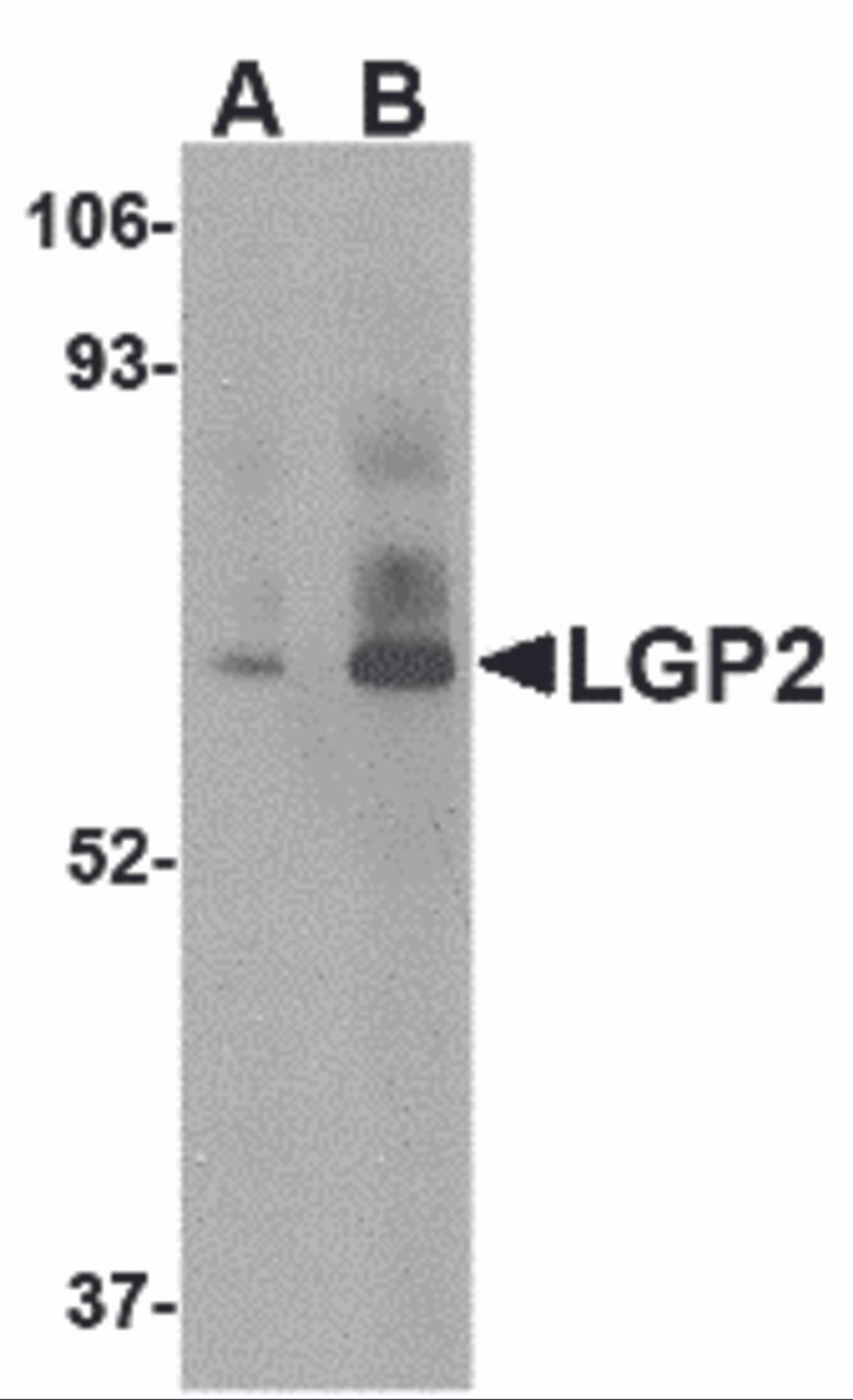 Western blot analysis of LGP2 in rat kidney tissue lysate with LGP2 antibody at (A) 1 and (B) 2 &#956;g/mL.