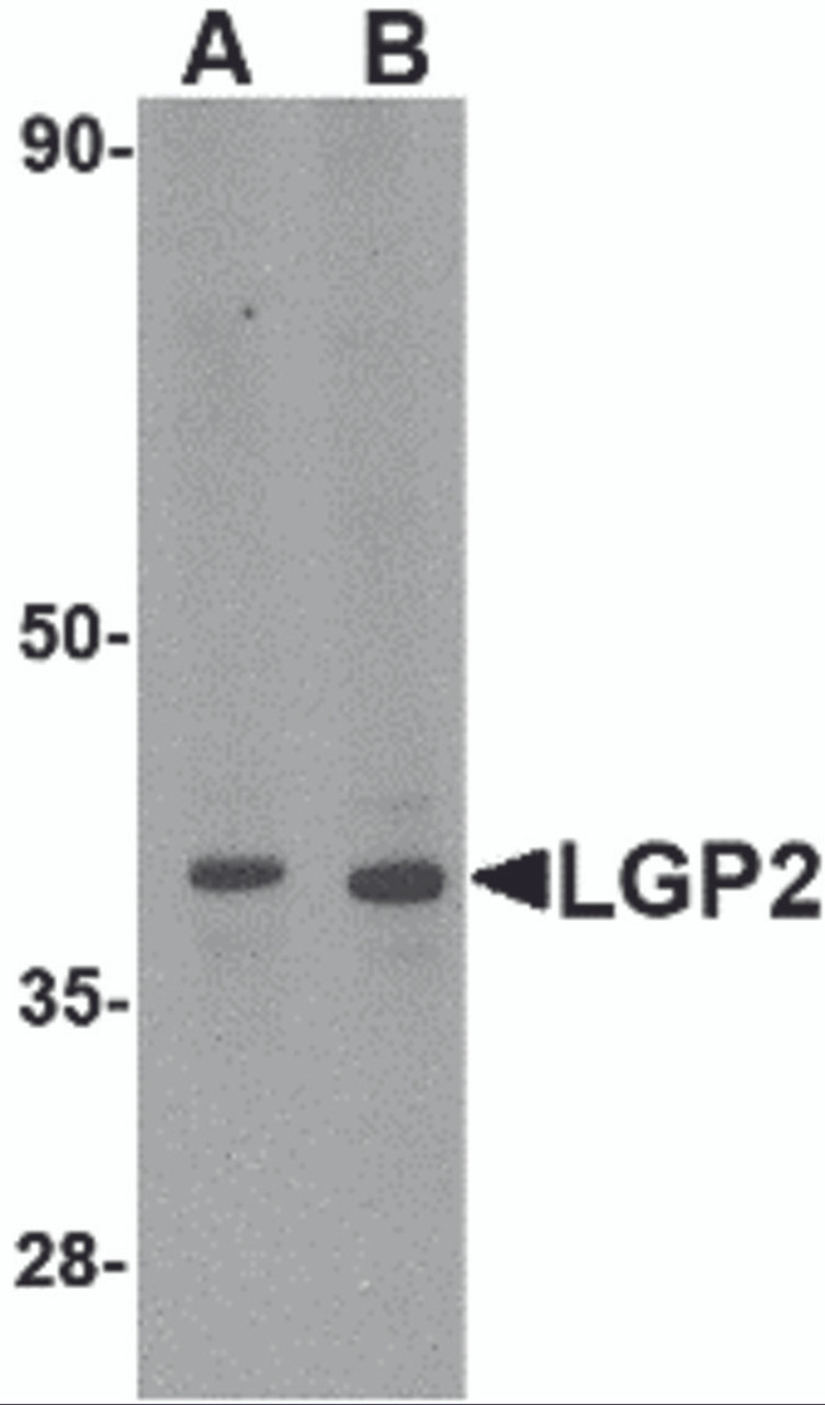 Western blot analysis of LGP2 in MDA-MB-361 cell lysate with LGP2 antibody at (A) 0.5 and (B) 1 &#956;g/mL.