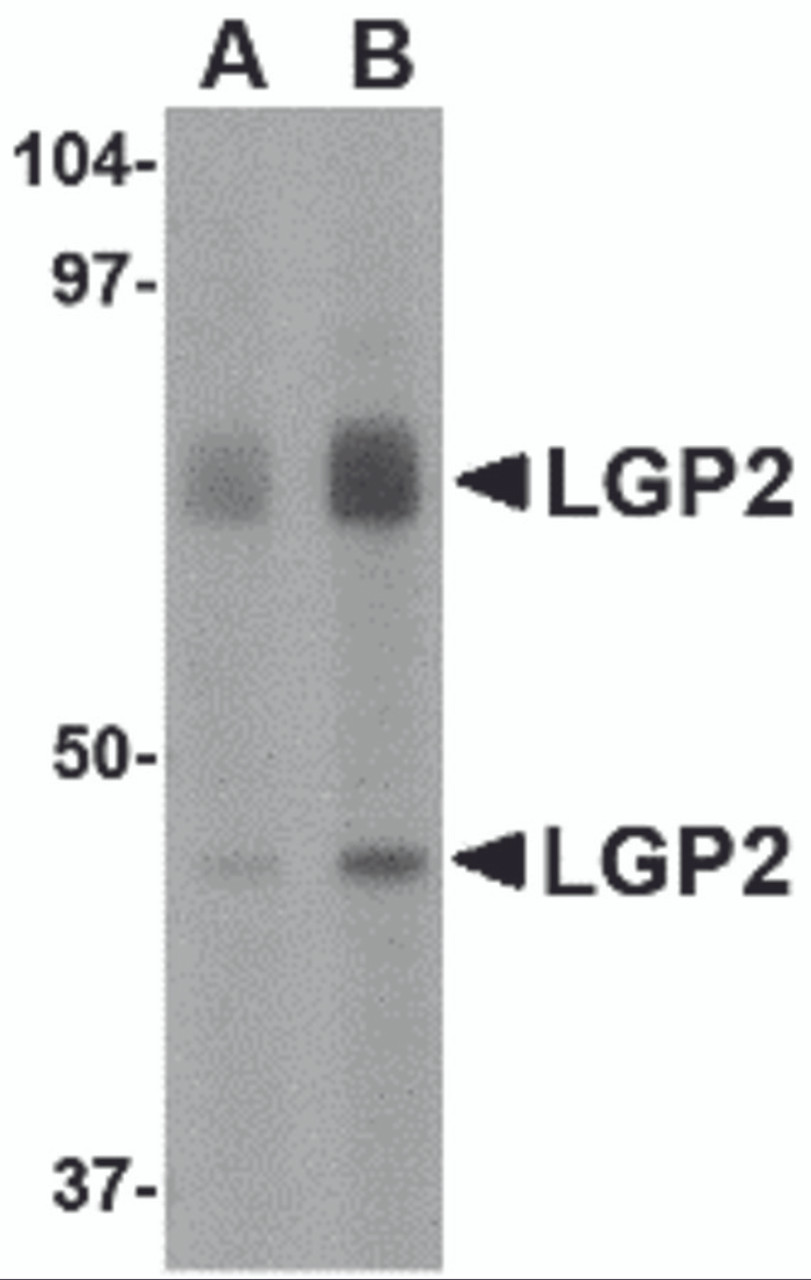 Western blot analysis of LGP2 in rat kidney tissue lysate with LGP2 antibody at (A) 1 and (B) 2 &#956;g/mL.