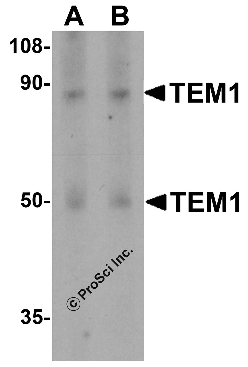 Figure 1 Western Blot Validation in Human Colon Tissue 
Loading: 15 &#956;g of lysates per lane.
Antibodies: TEM-1 4357, (A, 0.5 &#956;g/mL; B, 1 &#956;g/mL) , 1h incubation at RT in 5% NFDM/TBST.
Secondary: Goat anti-rabbit IgG HRP conjugate at 1:10000 dilution.