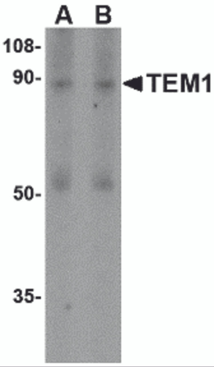 Figure 1 Western Blot Validation in Human Colon Tissue 
Loading: 15 &#956;g of lysates per lane.
Antibodies: TEM-1 4359, (A, 0.5&#956;g/mL; B, 1&#956;g/mL) , 1h incubation at RT in 5% NFDM/TBST.
Secondary: Goat anti-rabbit IgG HRP conjugate at 1:10000 dilution.