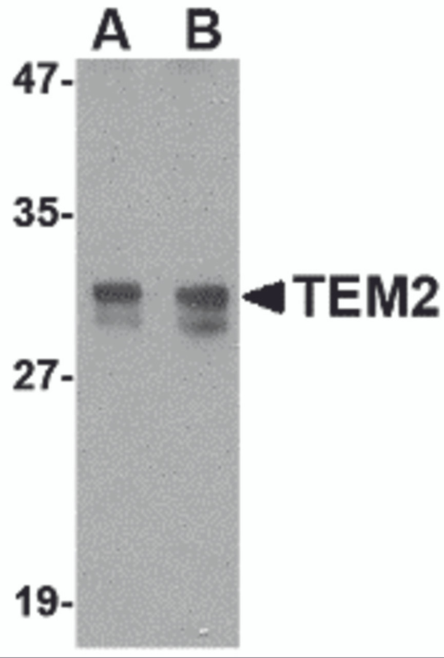 Western blot analysis of TEM2 in rat colon tissue lysate with TEM2 antibody at (A) 1 and (B) 2 &#956;g/mL.