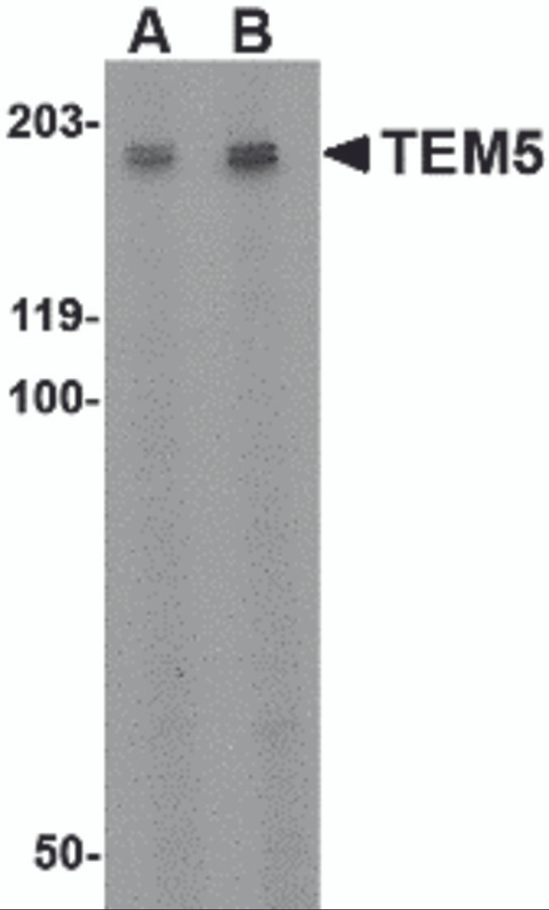 Western blot analysis of TEM5 in rat kidney tissue lysate with TEM5 antibody at (A) 2 &#956;g/ml and (B) 4 &#956;g/mL.