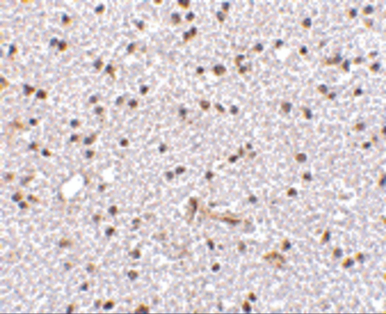 Immunohistochemistry of TOCA-1 in human brain tissue with TOCA-1 antibody at 2.5 ug/mL.