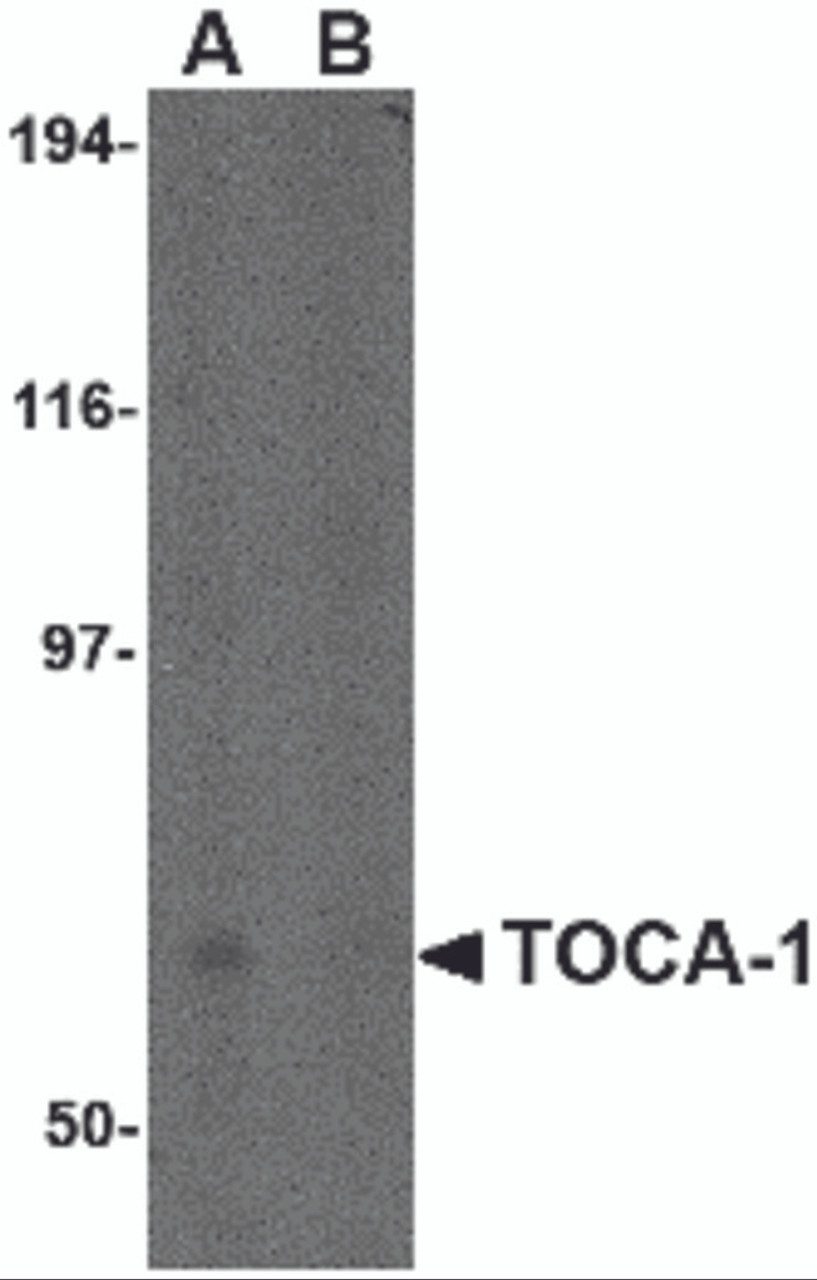 Western blot analysis of TOCA-1 in human brain tissue lysate in (A) the absence and (B) the presence of blocking peptide with TOCA-1 antibody at 0.5 &#956;g/mL.