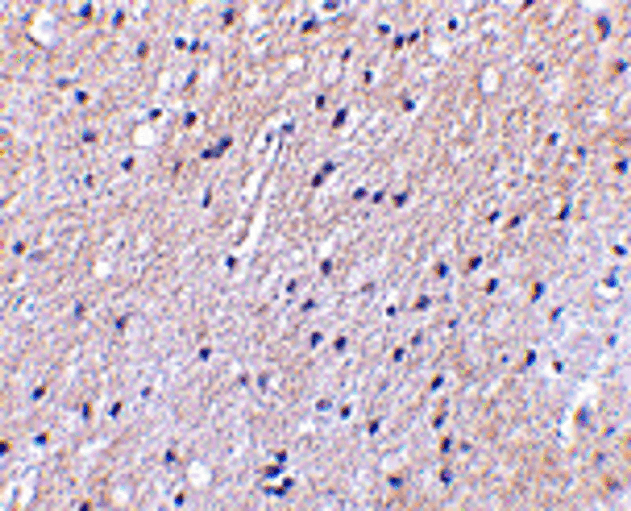 Immunohistochemical staining of human brain tissue using Nhe-1 antibody at 2.5 ug/mL.