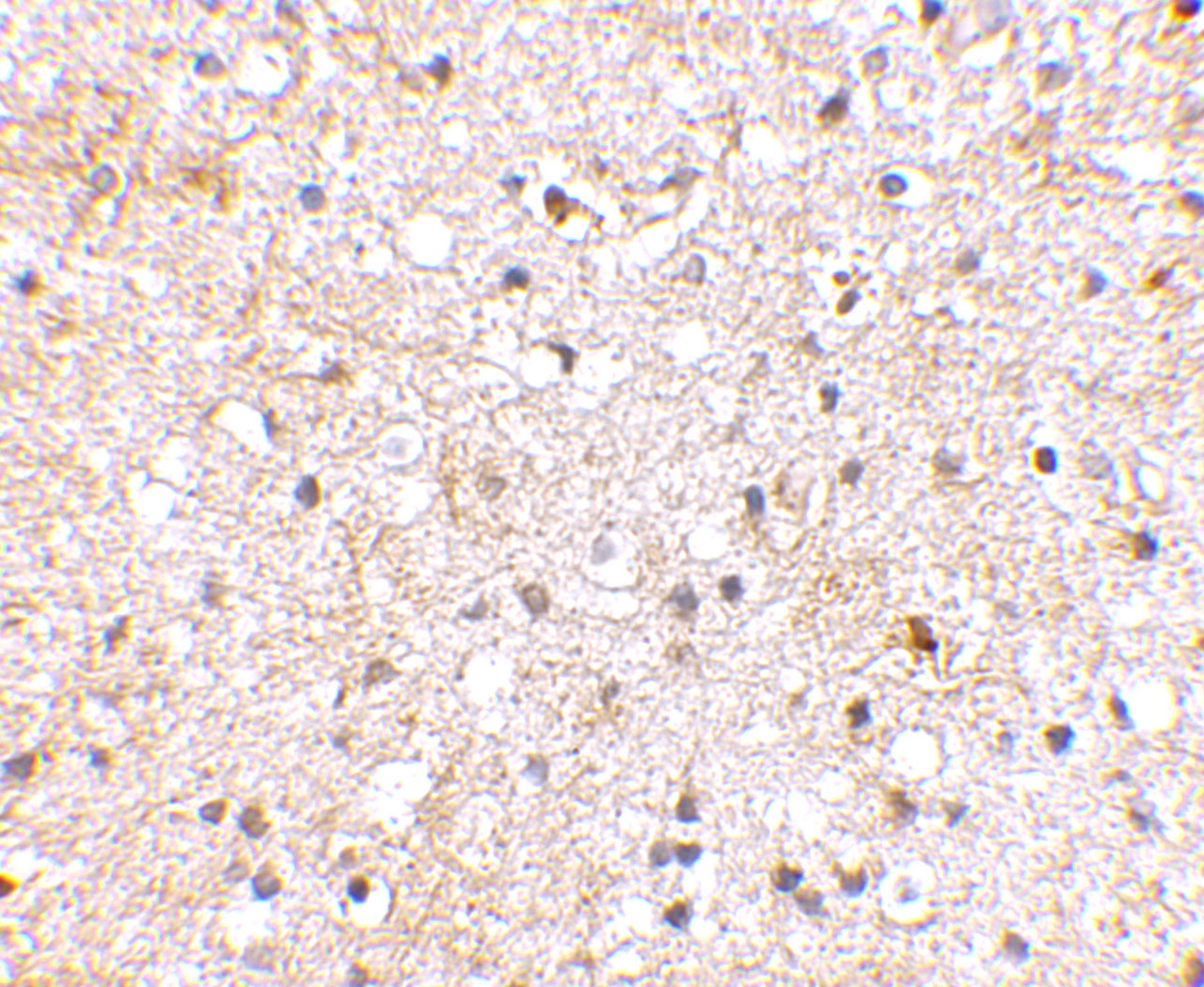 Immunohistochemical staining of human brain tissue using Grik1 antibody at 2.5 ug/mL.