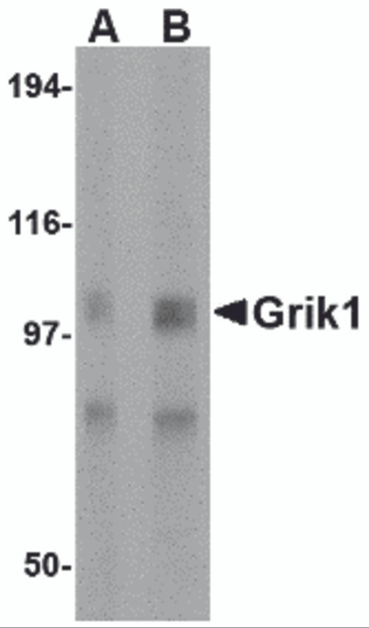 Western blot analysis of Grik1 in rat brain tissue lysate with Grik1 antibody at (A) 0.5 and (B) 1 &#956;g/mL.
