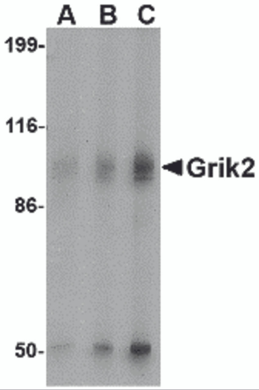 Western blot analysis of Grik2 in human brain tissue lysate with Grik2 antibody at (A) 0.5 and (B) 1 &#956;g/mL.