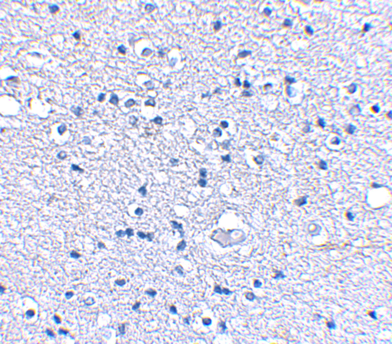 Immunohistochemical staining of human brain tissue using Grik4 antibody at 2.5 ug/mL.
