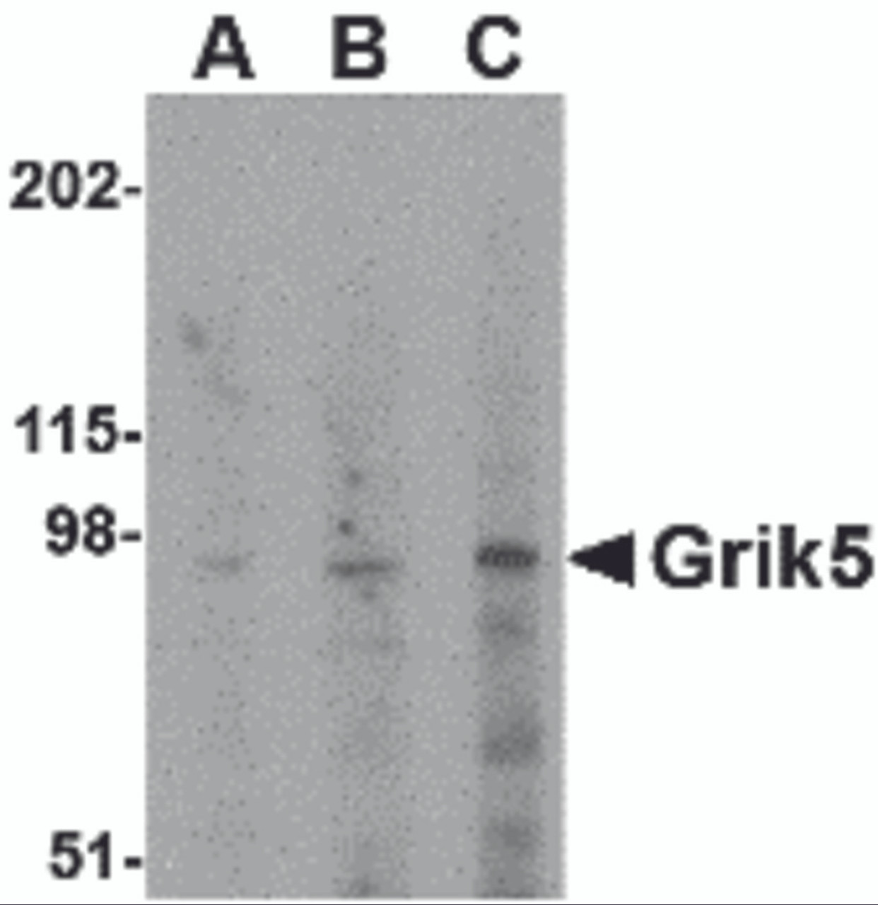 Western blot analysis of Grik5 in human brain tissue lysate with Grik5 antibody at (A) 0.5, (B) 1 and (C) 2 &#956;g/mL.