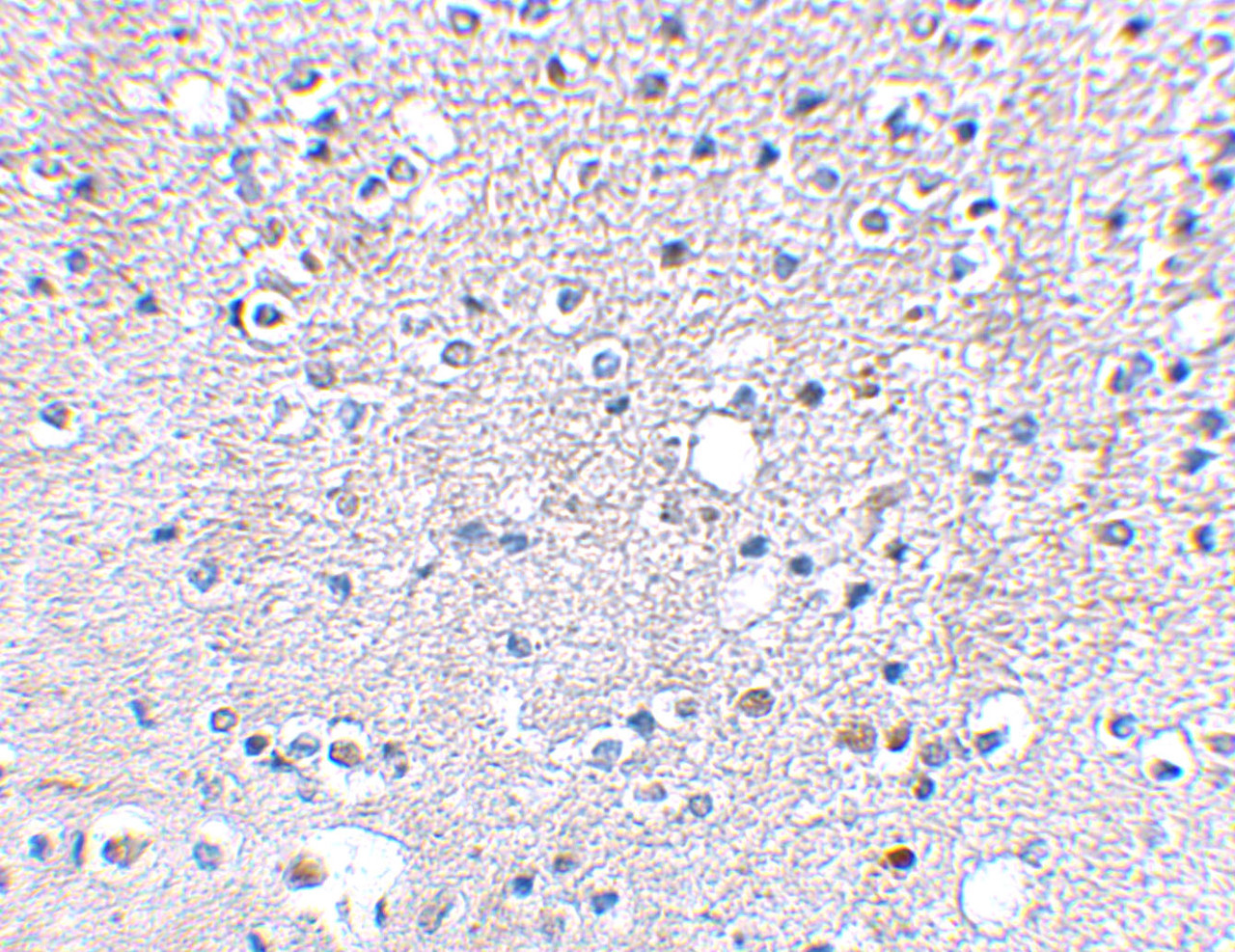Immunohistochemical staining of human brain tissue using Grik5 antibody at 2.5 ug/mL.
