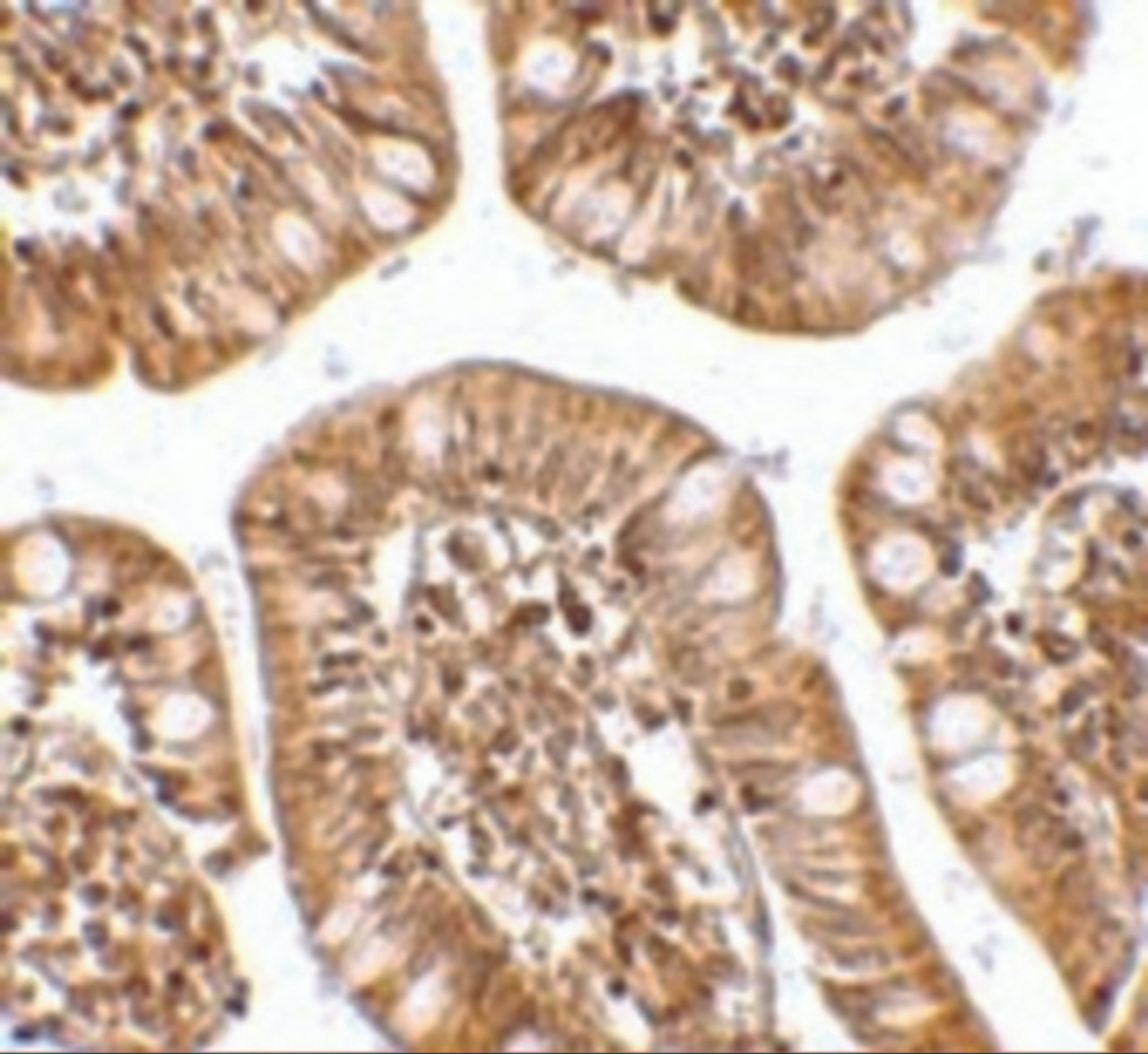 Immunohistochemistry of ZBP1 in human small intestine tissue with ZBP1 antibody at 2.5 ug/mL.