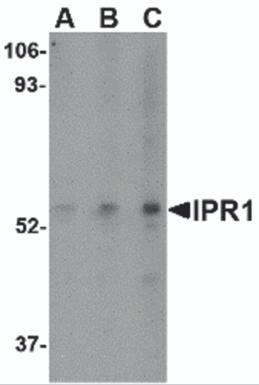 Western blot analysis of IPR1 in Hela cell lysate with IPR1 antibody at (A) 0.5, (B) 1, and (C) 2 &#956;g/mL.
