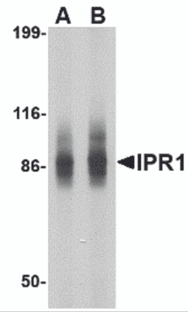 Western blot analysis of IPR1 in SW480 cell lysate with IPR1 antibody at (A) 1 and (B) 2 &#956;g/mL.