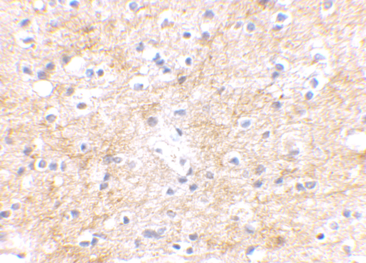 Immunohistochemical staining of human brain tissue using SAPAP3 antibody at 2.5 ug/mL.