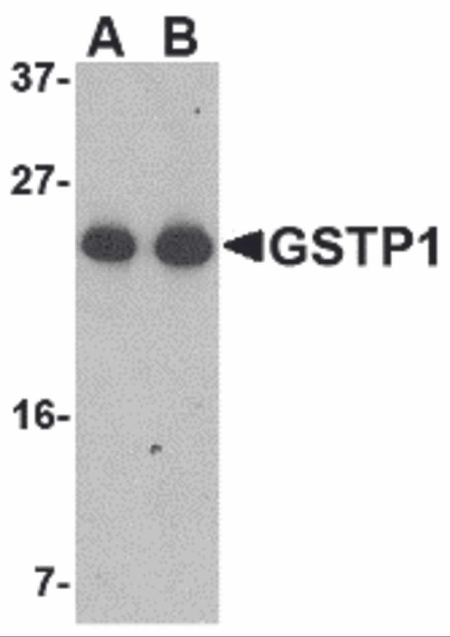 Western blot analysis of GSTP1 in Jurkat cell lysate with GSTP1 antibody at (A) 0.5 and (B) 1 &#956;g/mL.