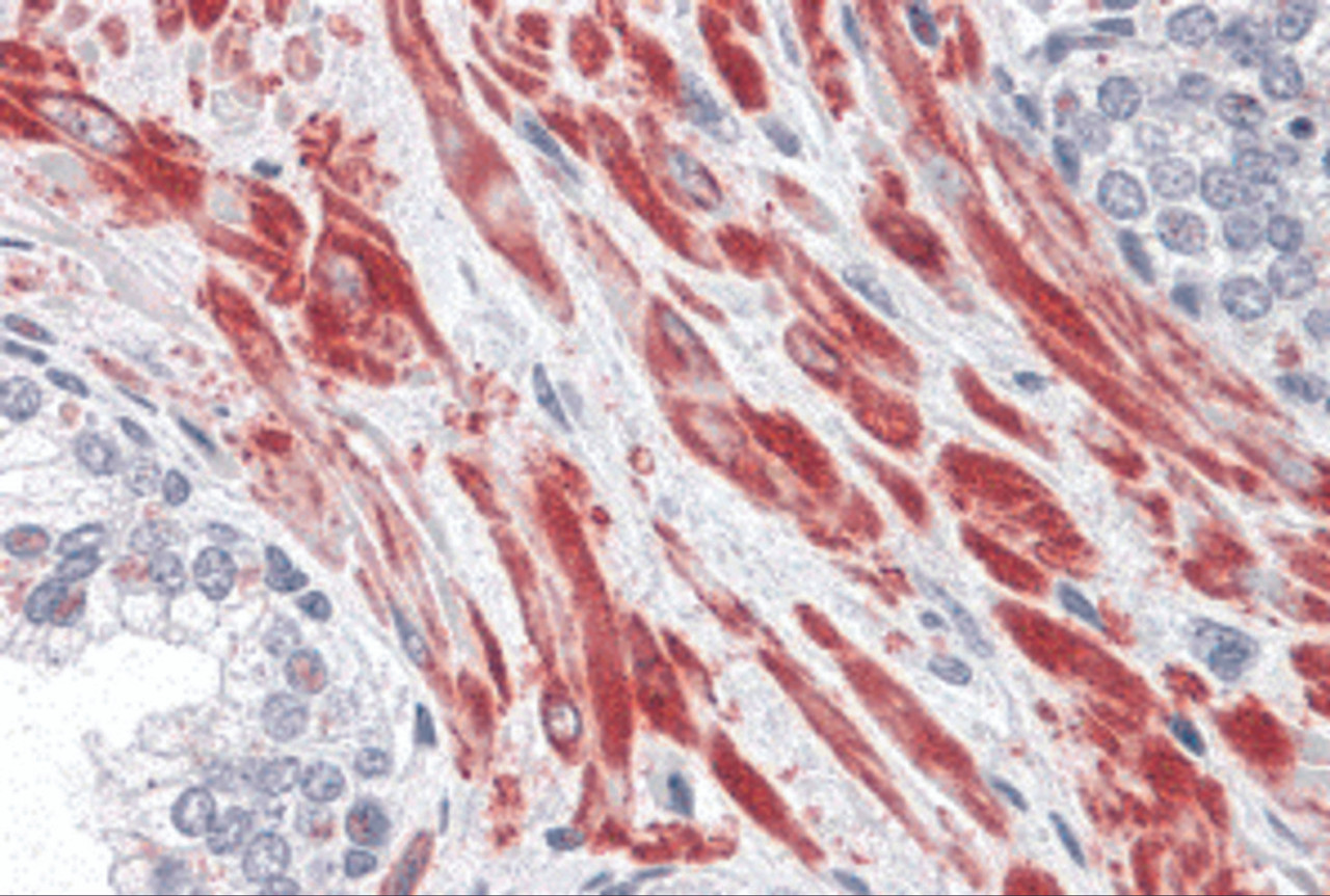 Immunohistochemistry of TBC1D4 in human prostate tissue with TBC1D4 antibody at 10 &#956;g/mL.