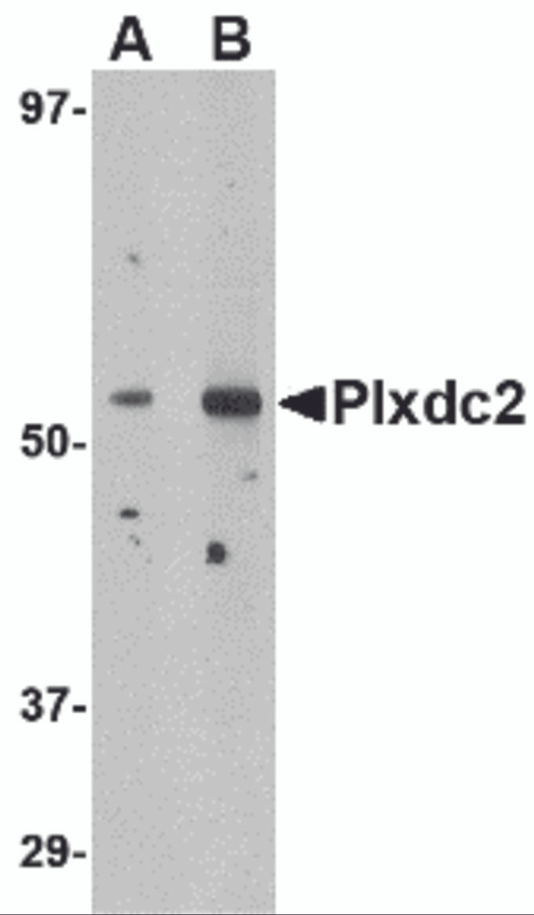 Western blot analysis of Plxdc2 in human brain tissue lysate with Plxdc2 antibody at (A) 0.5 (B) 1 &#956;g/mL.